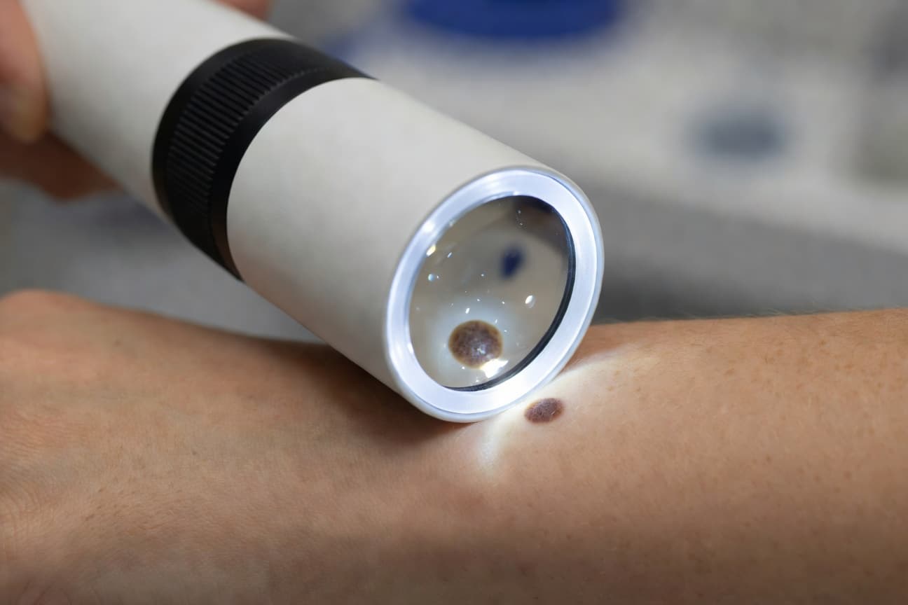 When to See a Dermatologist health guide